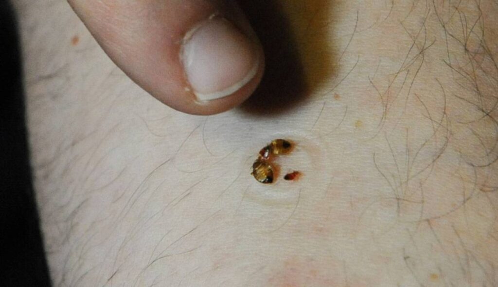 Sospechan brote de enfermedad de Chagas en la sierra de Durango
