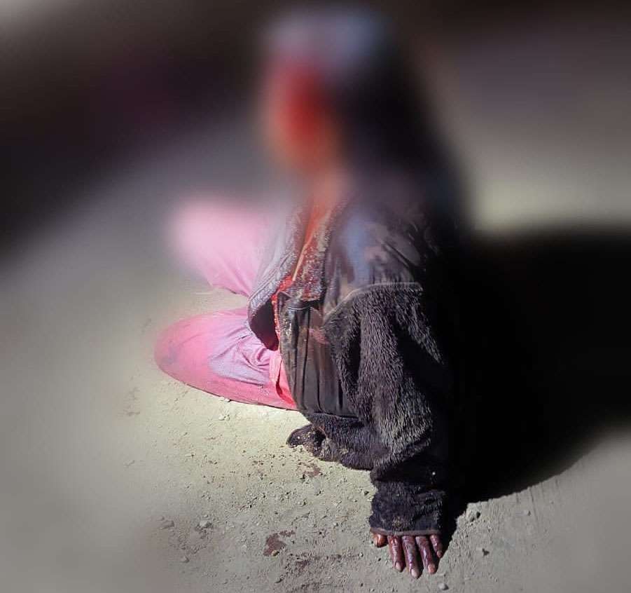 Su propio hijo de la un botellazo en la cabeza