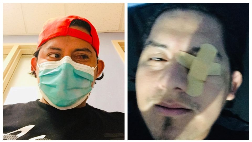 Un hombre perderá un ojo al observar el Eclipse Solar sin protección