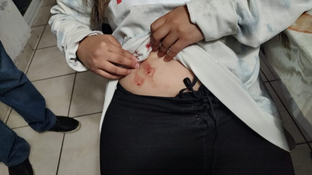 Por segunda ocasión acuchillan a estudiante de veterinaria
