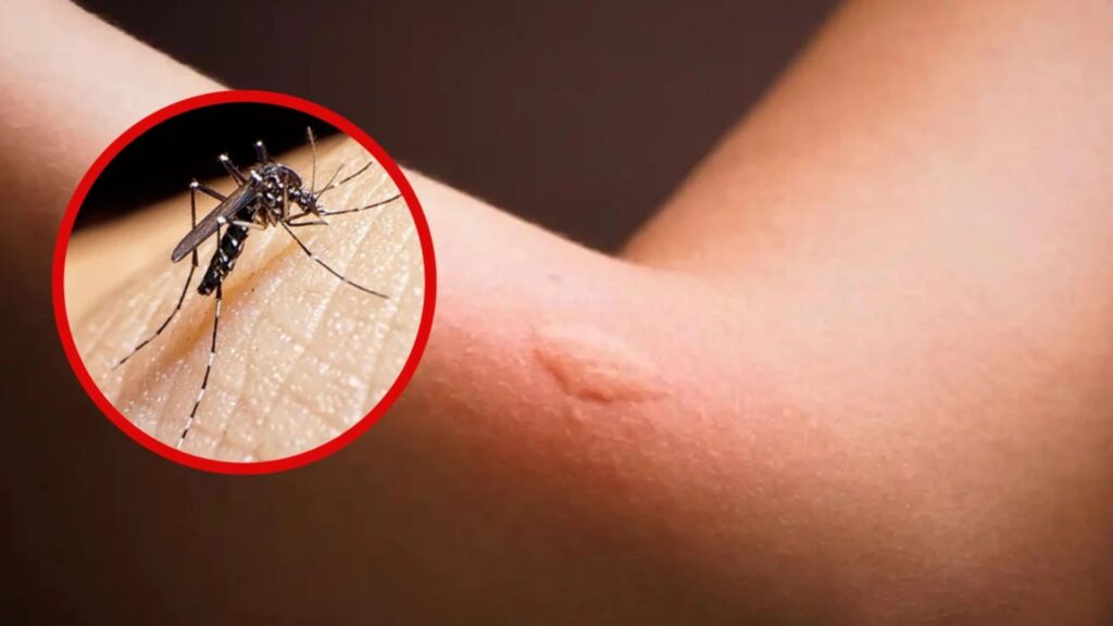 Muere niño por dengue en Nuevo León; hay 25 casos confirmados