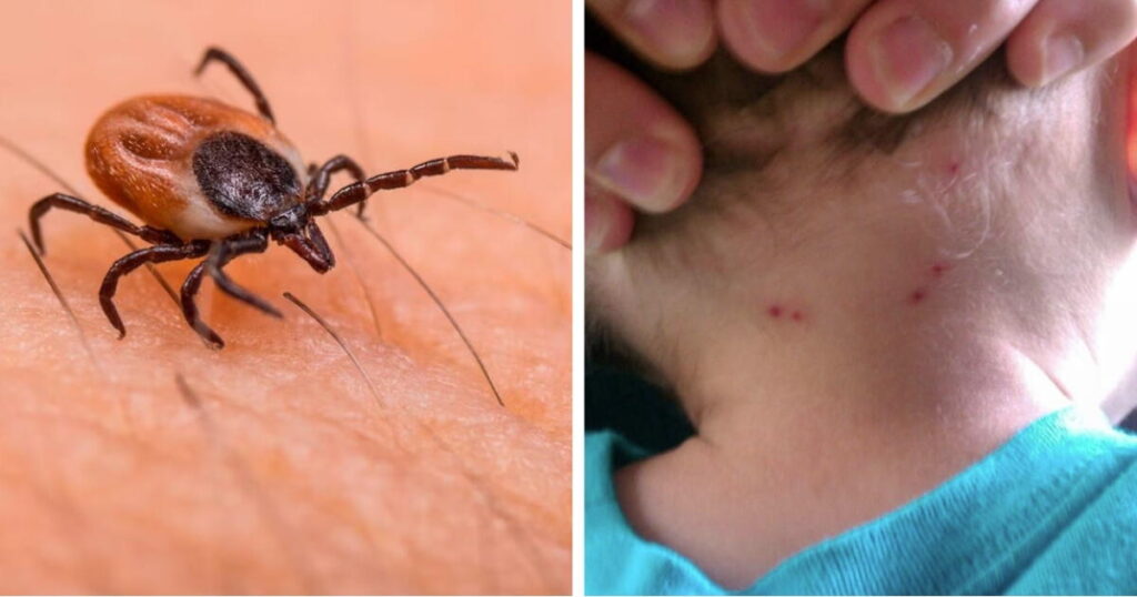 Mueren dos hermanitos por picadura de garrapata