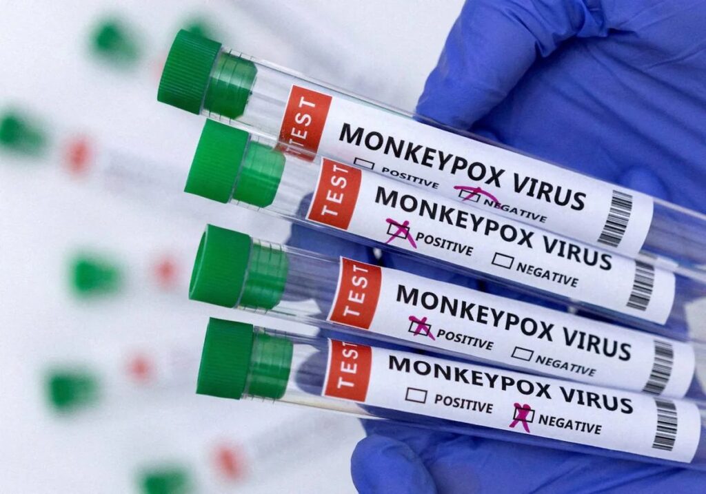 Puebla ha confirmado dos casos de viruela del mono durante 2024