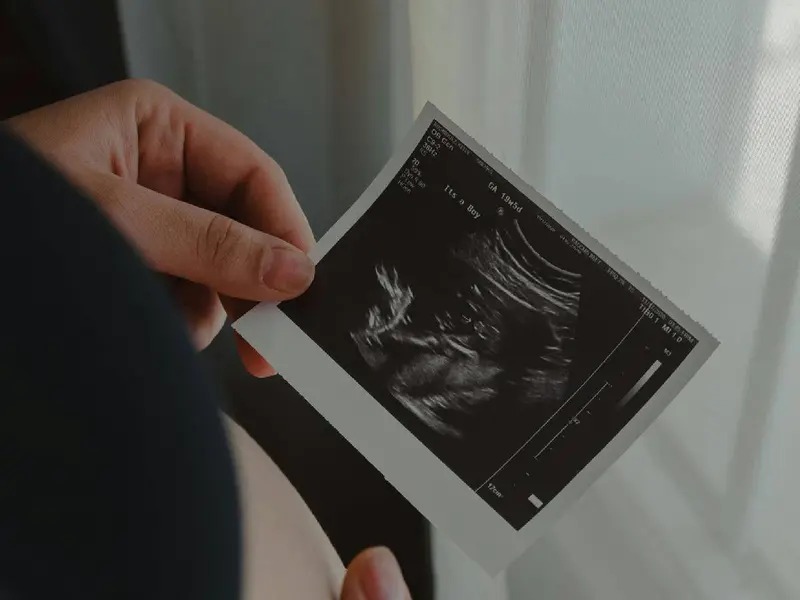 Corte de Arizona determina que un feto puede ser descrito como «ser humano por nacer»