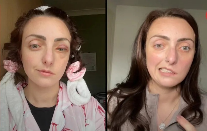 Jade-Marie Clark, lucha contra un raro tumor cerebral y la parálisis facial, pensó que era tic nervioso