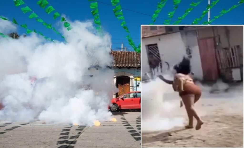Joven sufre graves lesiones faciales por explosión de pirotecnia