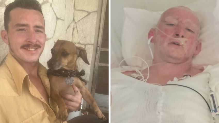 Perdió la piel, pero salvó a su perro: un hombre se lanza al fuego tras explosión de motocicleta