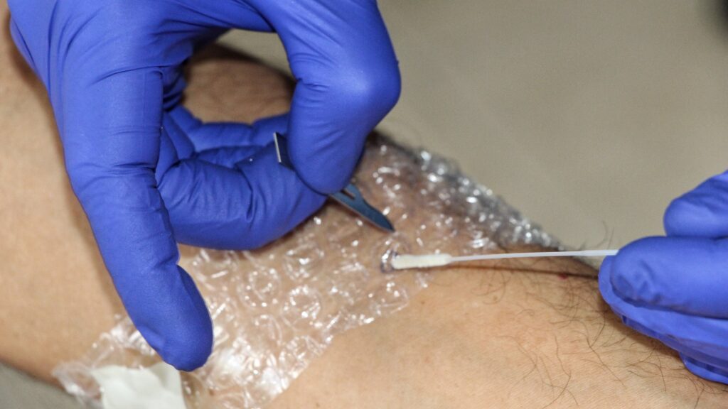Reitera Secretaría de Salud Jalisco llamado a reforzar prevención ante casos de Mpox