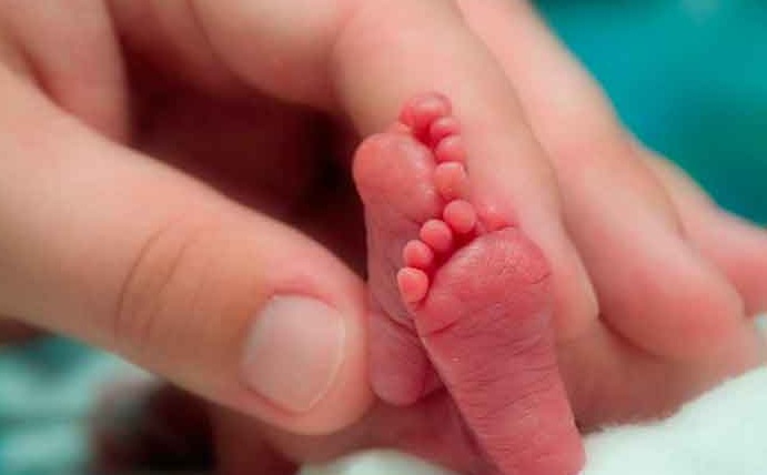 “Más pequeño que una toronja”: La increíble historia del bebé que rompió un récord mundial por nacer con solo 21 semanas