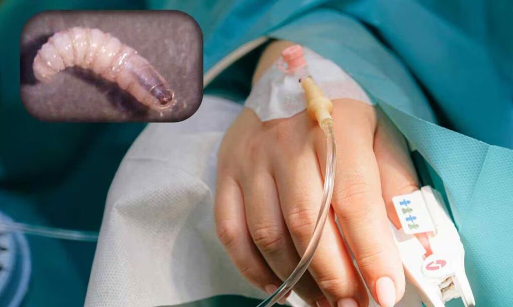 Casos de Miasis por Gusano Barrenador en el Sur de México