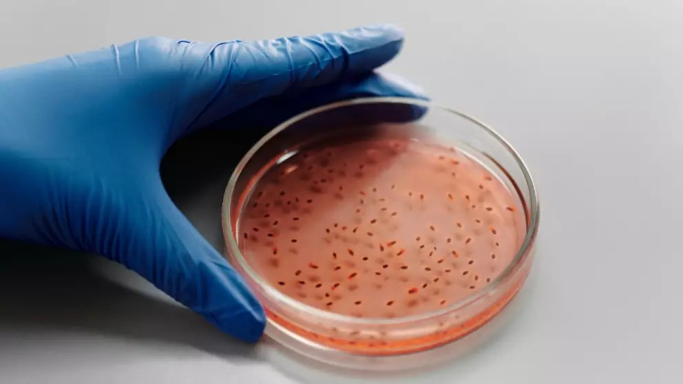 Bacteria carnívora en mariscos provoca alarma por aumento de casos y decesos