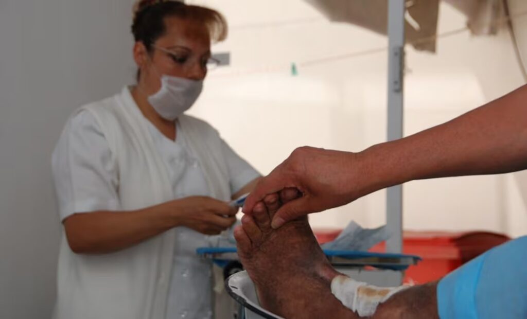 IMSS-Bienestar implementa medicamento de Cuba para tratar pie diabético