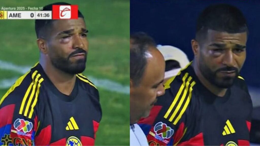 Búfalo Aguirre sufre impactante lesión en partido