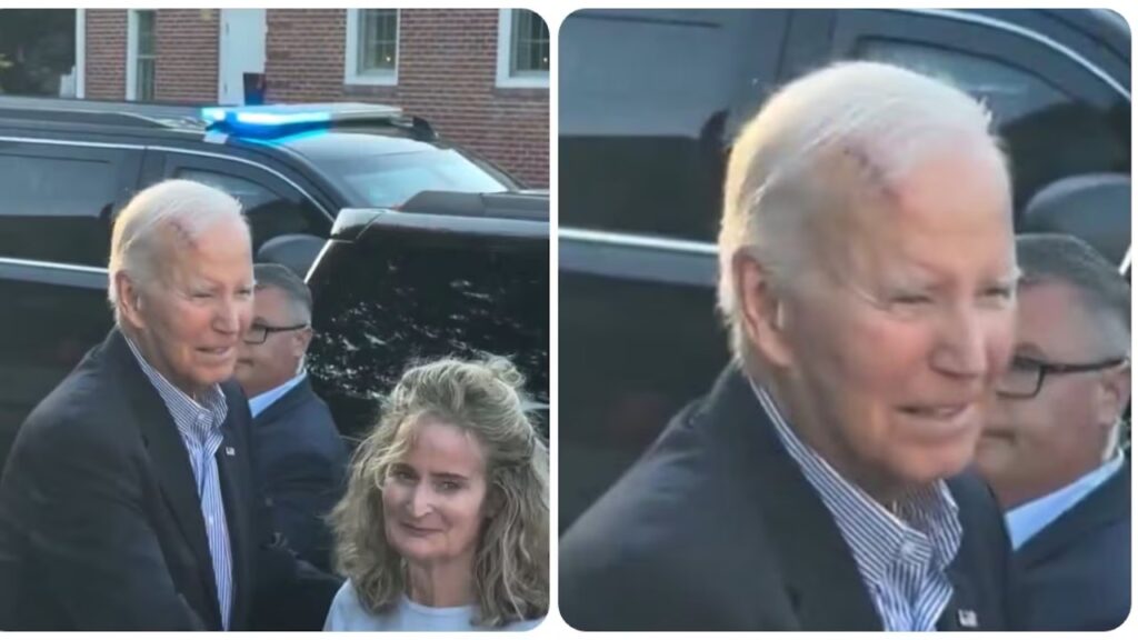 Biden se somete a cirugía para extirpar cáncer de piel y reaparece con vendaje en la cabeza