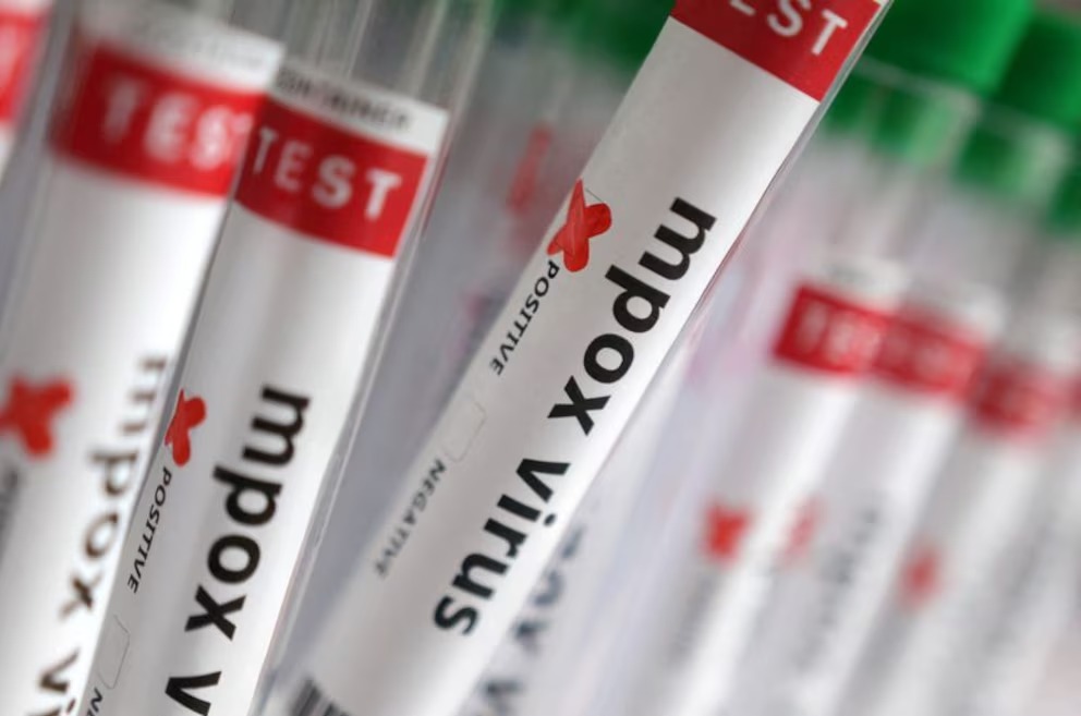 Detectan nueva cepa peligrosa de viruela del mono en California; autoridades en alerta sanitaria