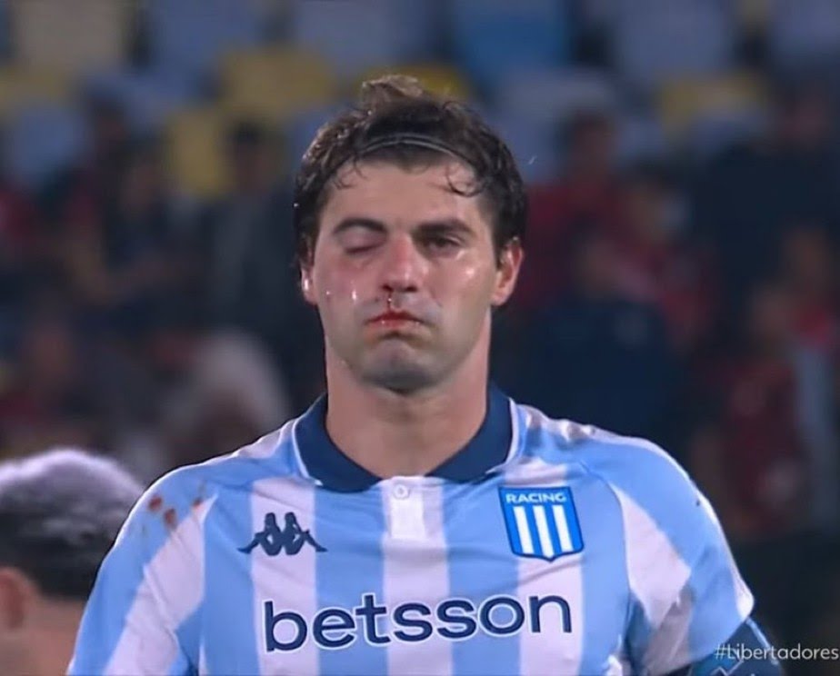 Impactante choque en Copa Libertadores: jugador termina noqueado por su compañero