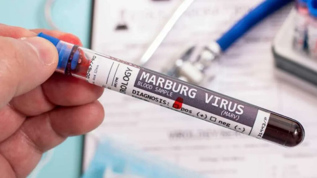 Reportan primer brote del virus de Marburgo