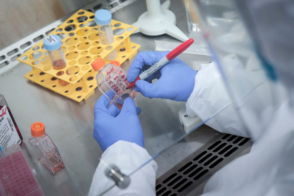 Etiopía investiga posible brote de fiebre hemorrágica viral