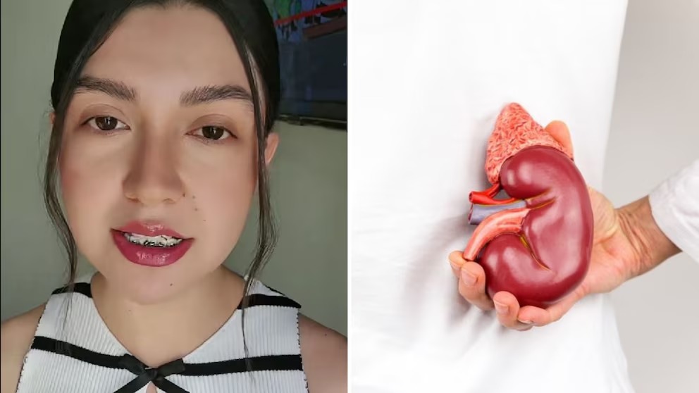 Joven le donó un riñón a su novio y un mes después se casó con la enfermera