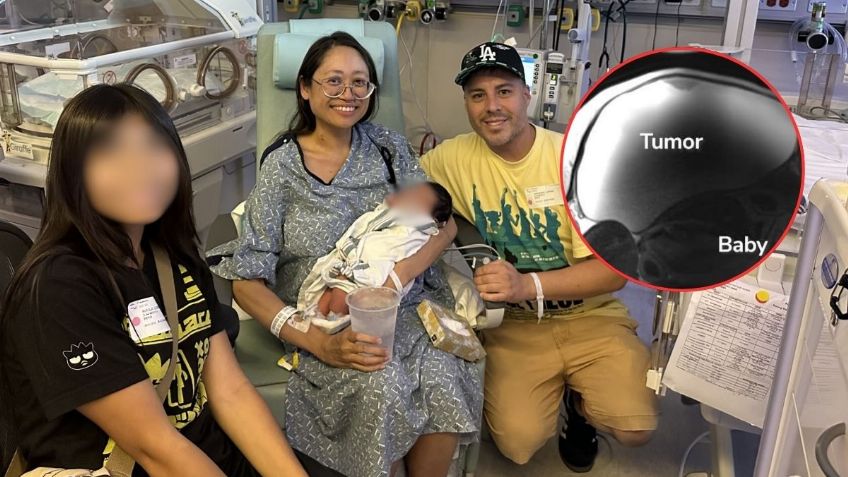 Mujer descubre que estaba embarazada tras confundirlo con un tumor de 10 kg