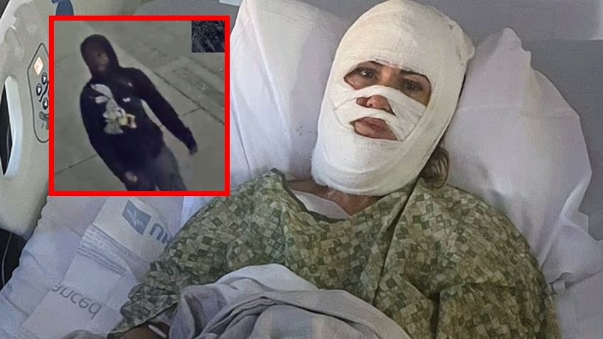 Desconocido arroja ácido a una mujer y le desfigura el rostro