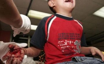 Evita que los Niños Jueguen con Pirotecnia, estas son las consecuencias