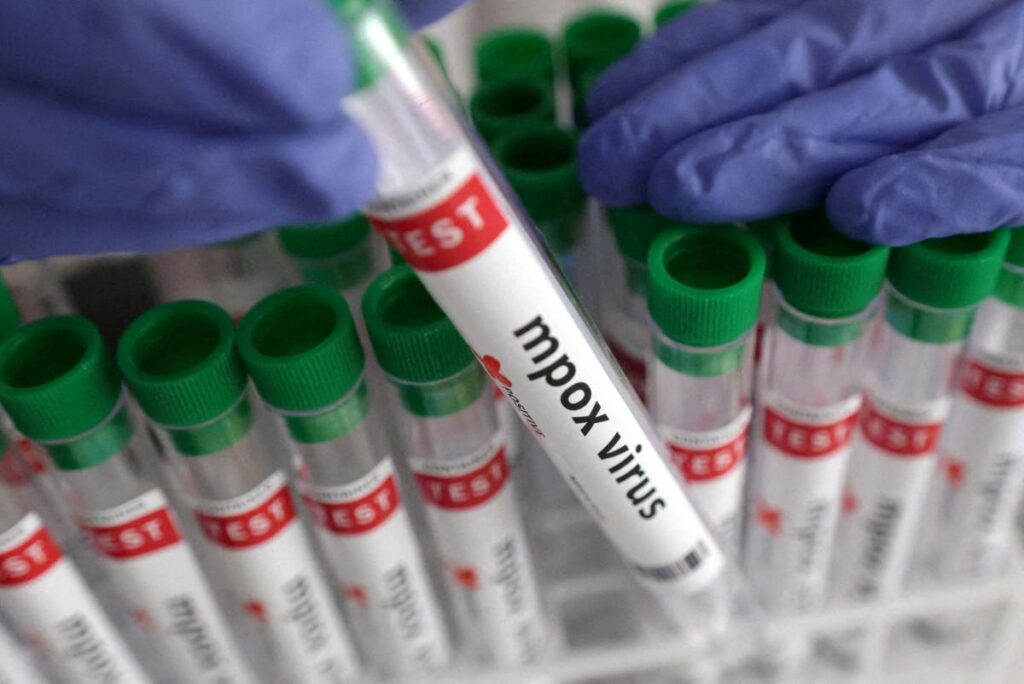 Emiten advertencia tras identificar una nueva cepa de mpox en Inglaterra