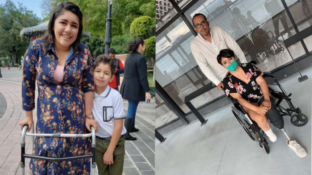 Madre soltera acudió a retirarse un DIU y terminó con ambas piernas amputadas