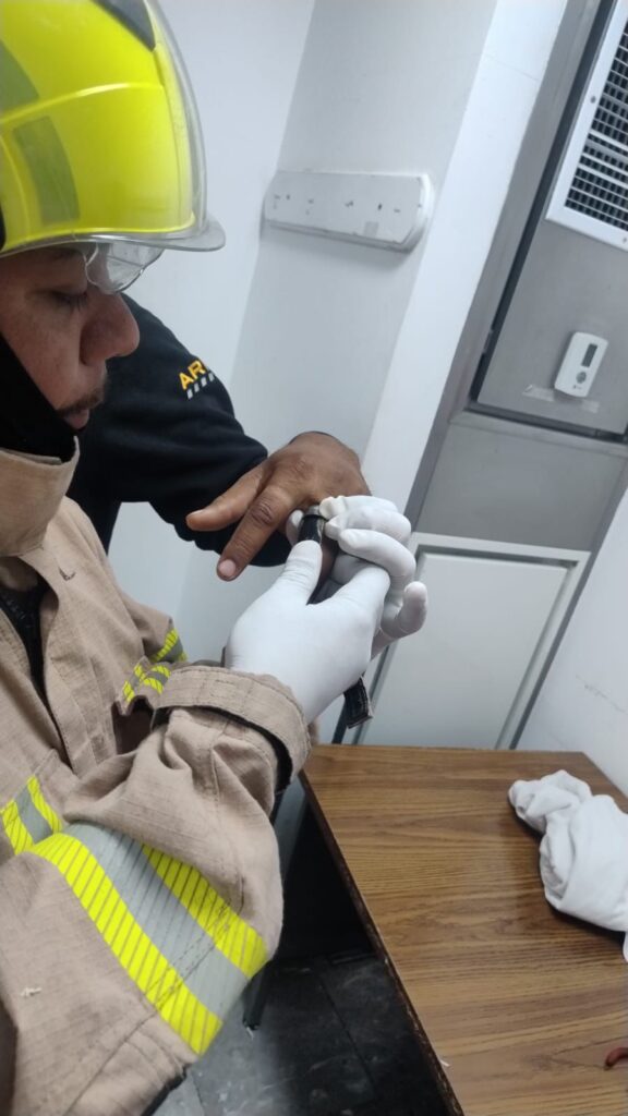 Bomberos retiran anillo de acero que se quedó atorado en un dedo de paciente del HG-450