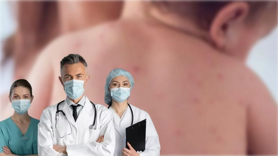 Sarampión en México: más de 200 casos en una semana