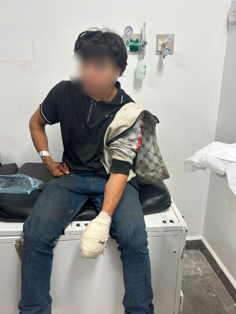 Minero pierde tres dedos de la mano izquierda en un accidente laboral