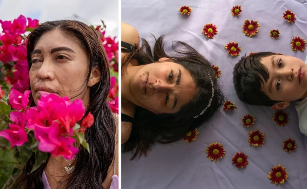 Mujeres transforman en arte sus historias como sobrevivientes de ataques con ácido