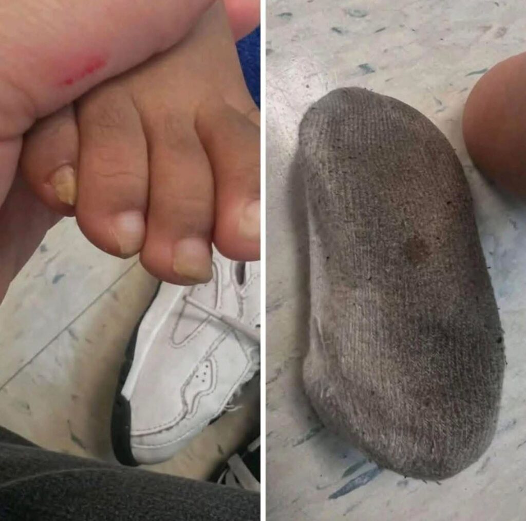 Le dolian sus pies, lo revisa la maestra y sus uñas meses sin cortar, se le enterraban