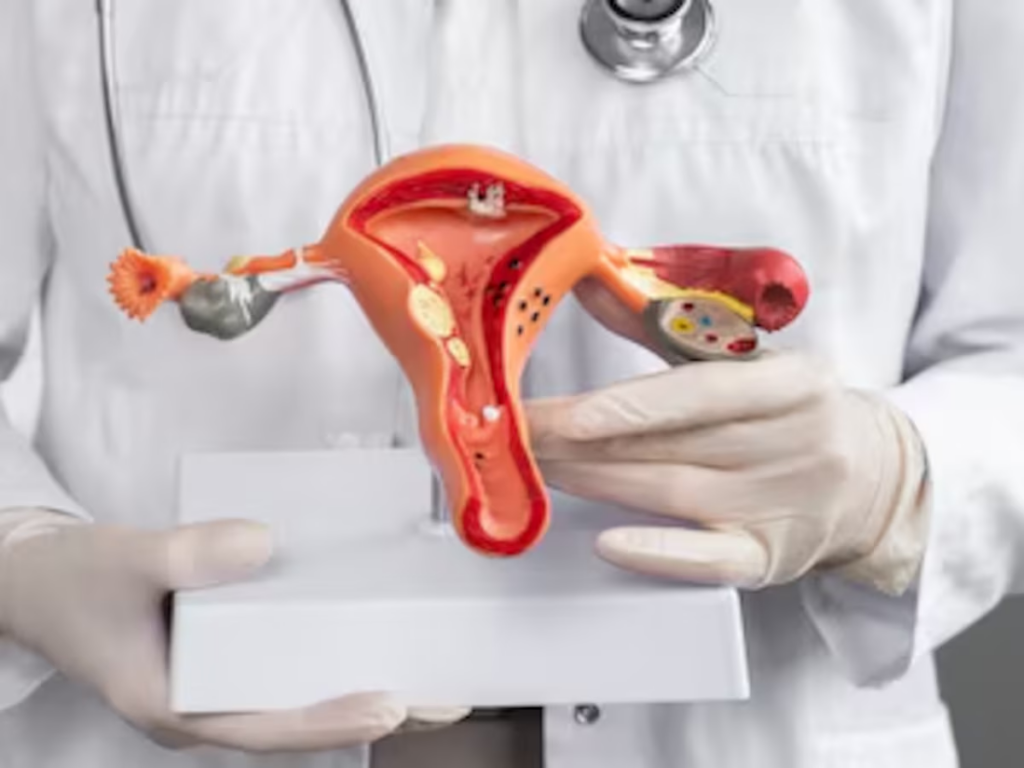 Repunta el cáncer cérvico uterino invasor en mujeres jóvenes