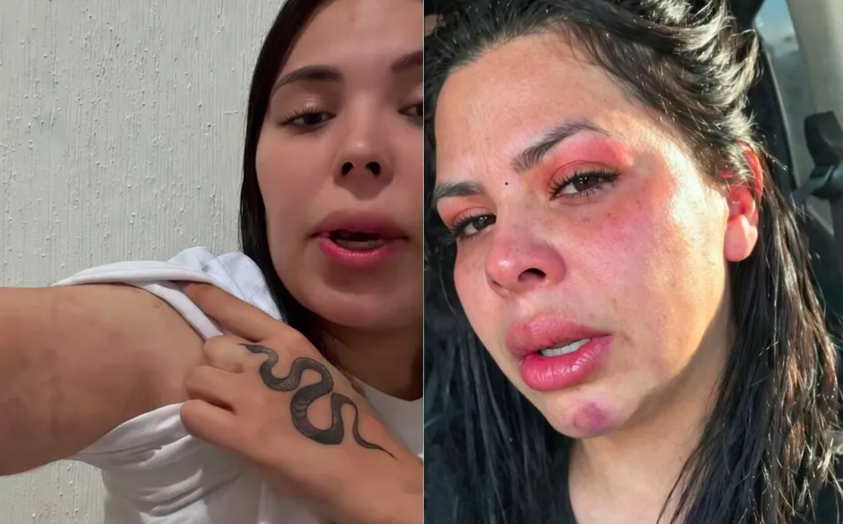 Filtran videos de Fernanda Redondo autolesionándose