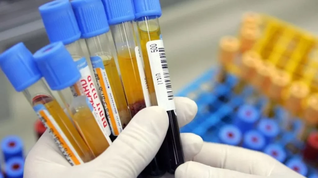 Análisis de sangre podría predecir demencia décadas antes