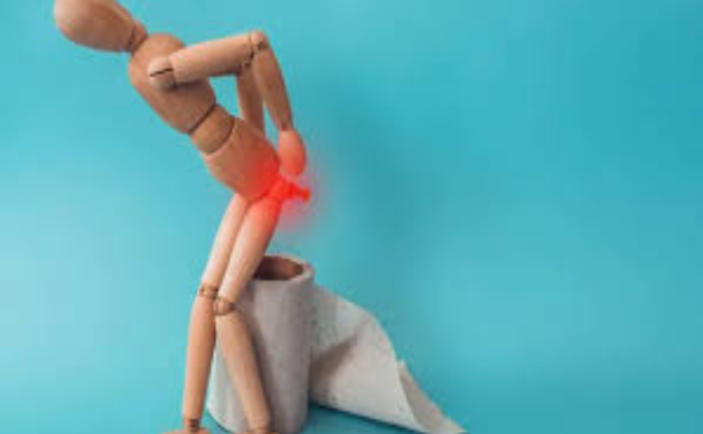 Prevención de hemorroides: hábitos clave para reducir el riesgo