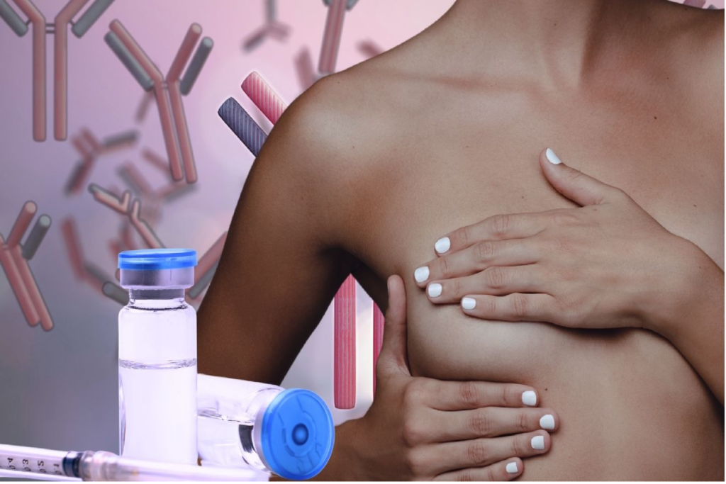 Cáncer de mama: señales que pueden salvarte la vida