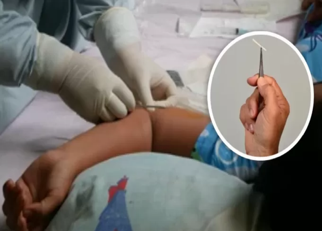 Así responde tu cuerpo después de dejar el implante anticonceptivo