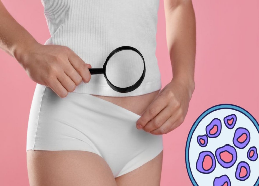 Clamidia: la infección silenciosa que afecta a mujeres