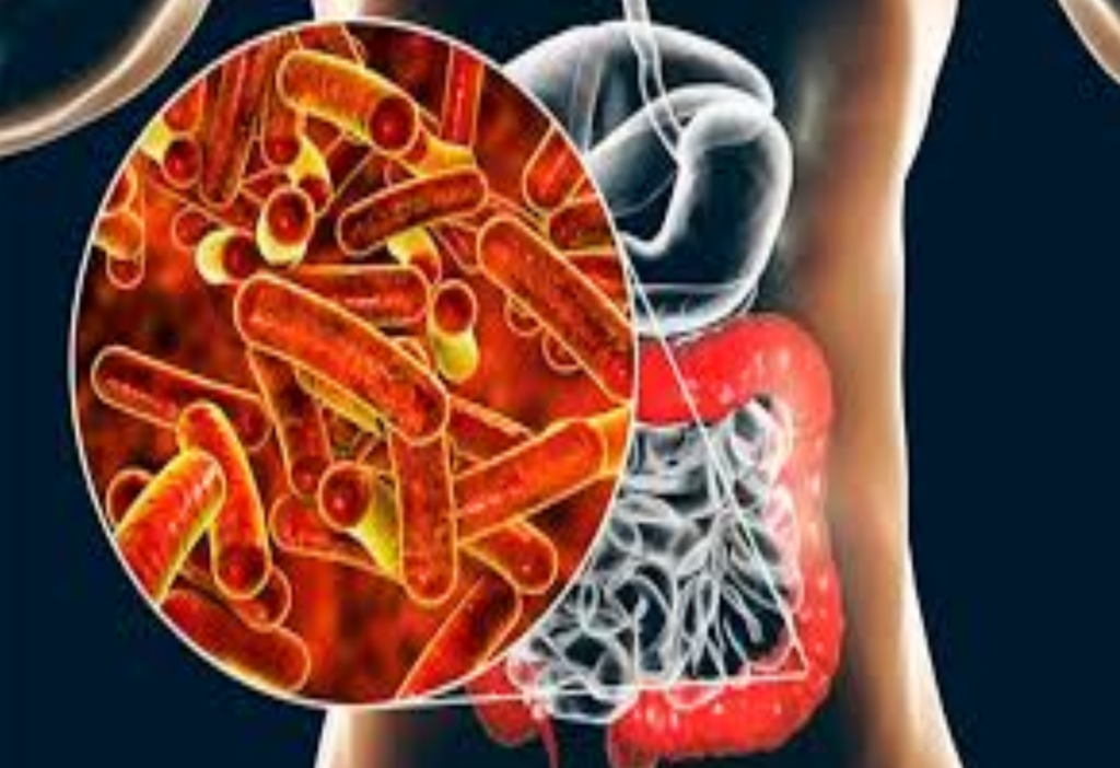 La shigelosis, una infección bacteriana que también puede transmitirse sexualmente