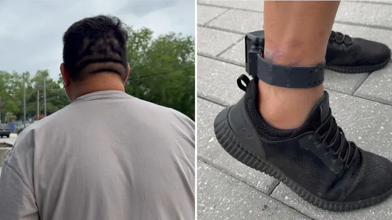 Migrante hondureño con diabetes denuncia infección por grillete electrónico de ICE