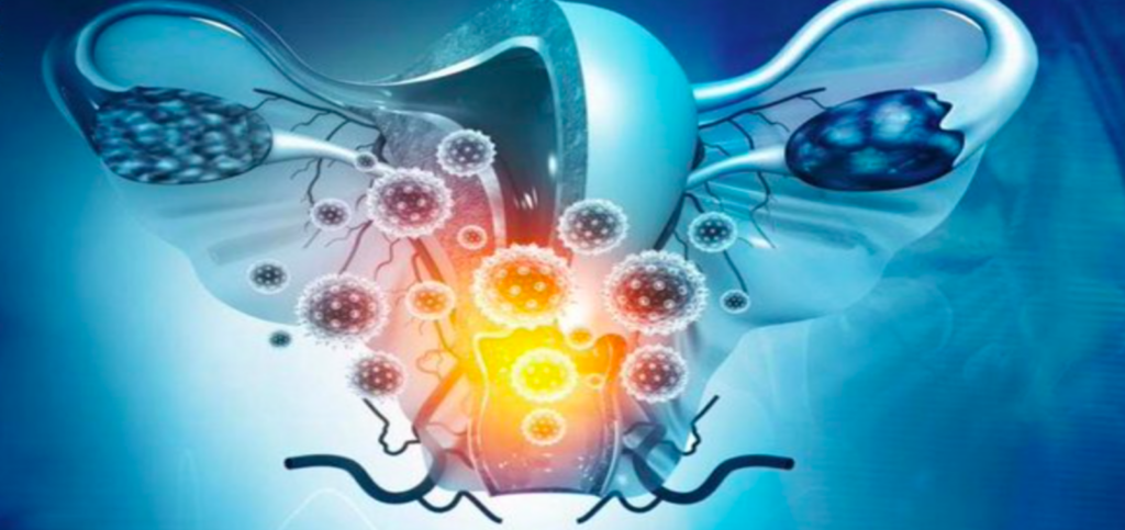 Especialistas identifican cómo el VPH influye en el desarrollo de cáncer cervicouterino
