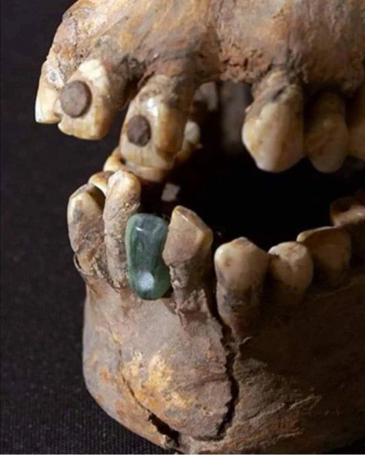 Descubren en Escocia un esqueleto con tecnología dental “imposible” para su época