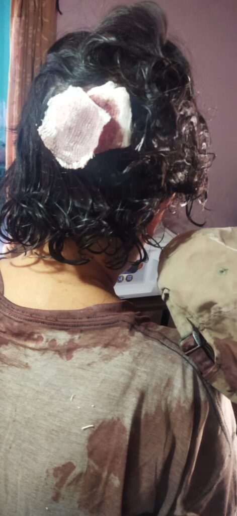 Violentada a casi morir, la tiro a un barranco, su perrito la salva y el MP de dia festivo