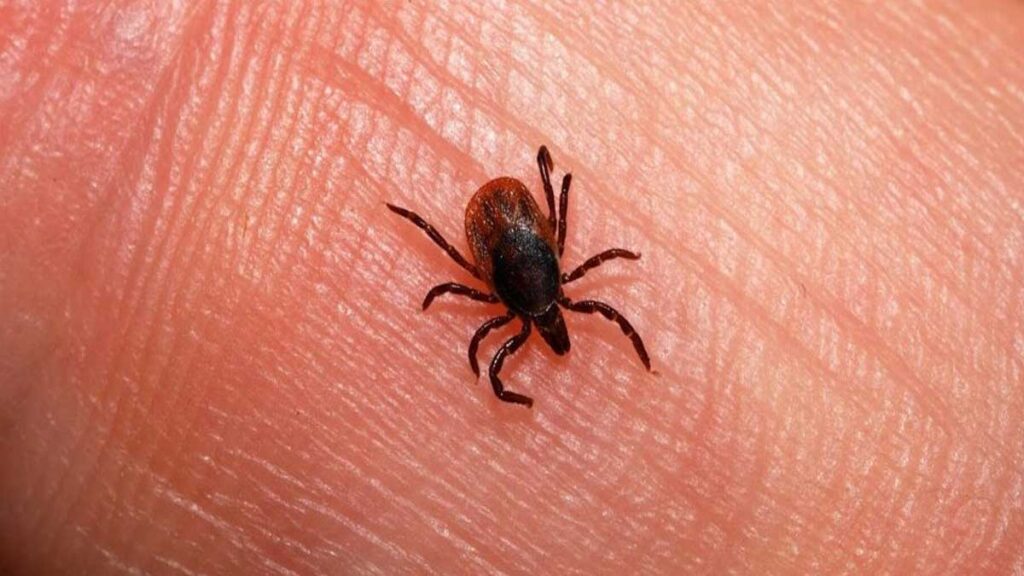 Investigan fallecimiento sospechoso por rickettsiosis en menor de 9 años en La Laguna