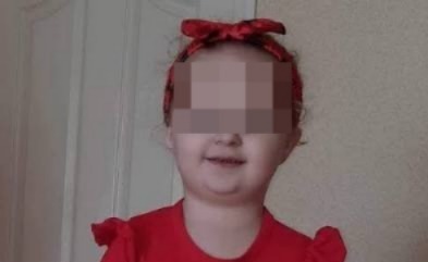 Niña de 3 años muere tras grave infestación de piojos que le causó anemia severa