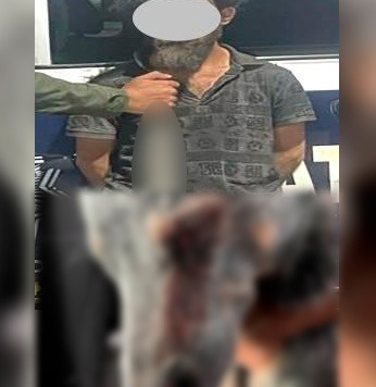 Fiscalía logró que el juez vinculara al que atacó con machete a perrito