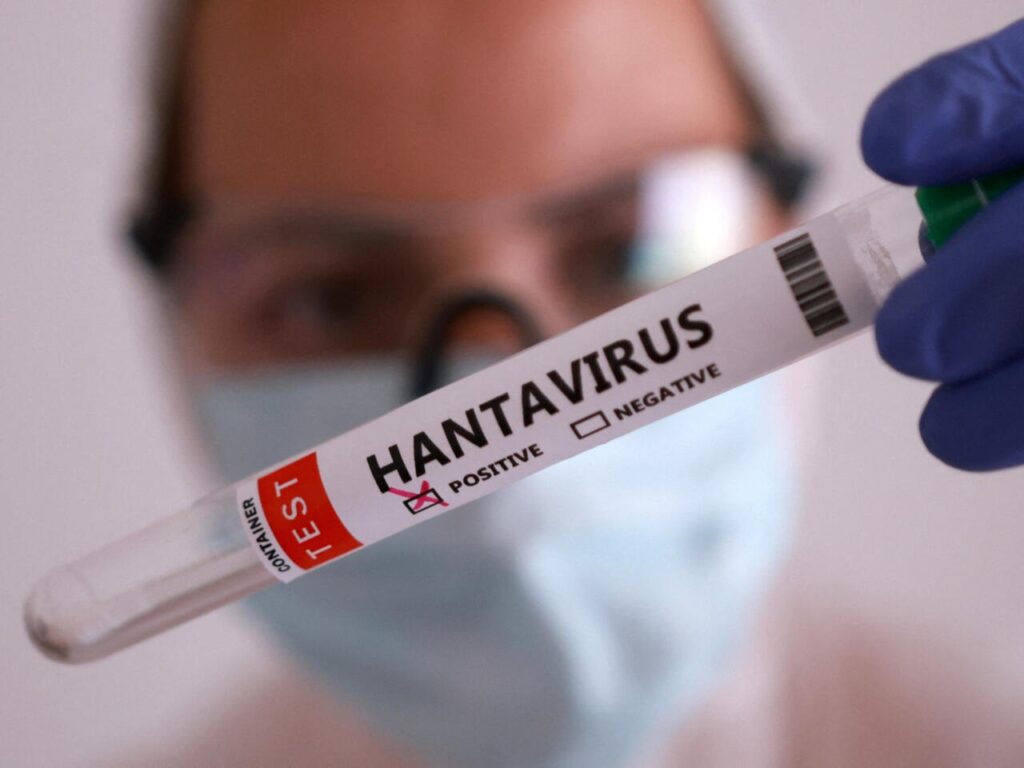 Venezuela confirma tres muertes por hantavirus; descartan transmisión entre personas