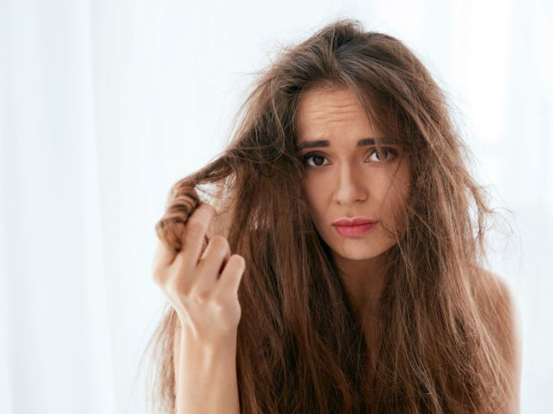 ¿Cabello en pausa? Conoce los síntomas y cuidados para fortalecerlo
